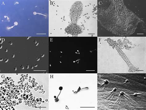  Dictyostelium:  The Slime Mold That Dances Its Way to Survival!