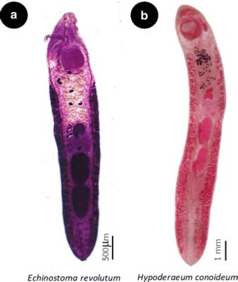  Echinostoma Revolutum: A Tiny Trematode That Lives a Life of Deception!