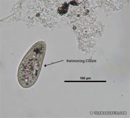  Rohanella - Một Ciliophora Nhỏ Bé Với Khả Năng Di Chuyển Kiểu Bơi Lượn Vô Cùng Uyển Ch карьера