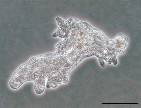  Vexillifer! A Single-Celled Amoeboid Marvel Mastering Microscopic Movements